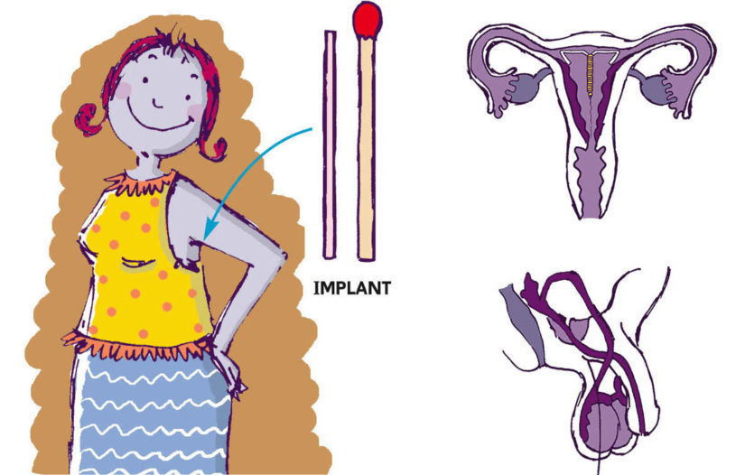 brochure : “La contraception“ : 20 illustrations, traduite en 10 langues (plume et palette graphique)